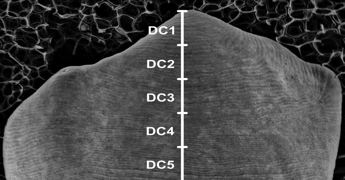 AI revolutionizes dental anthropology research