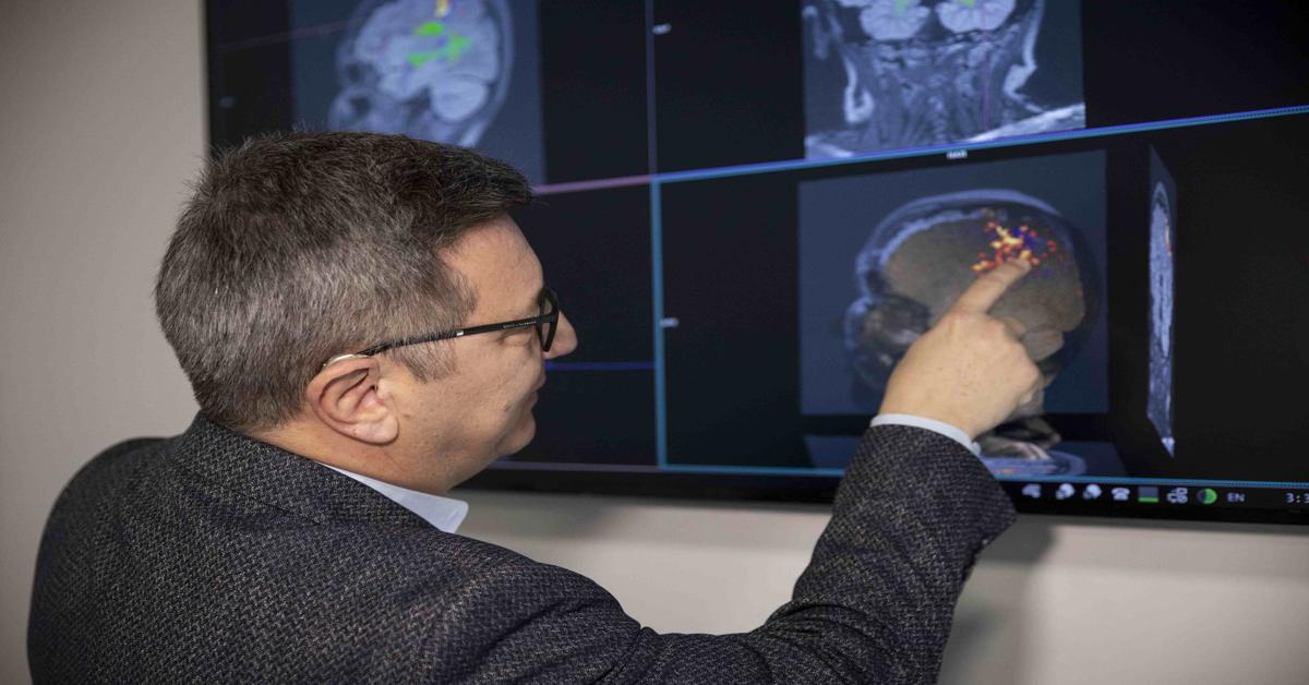 Stress alters brain