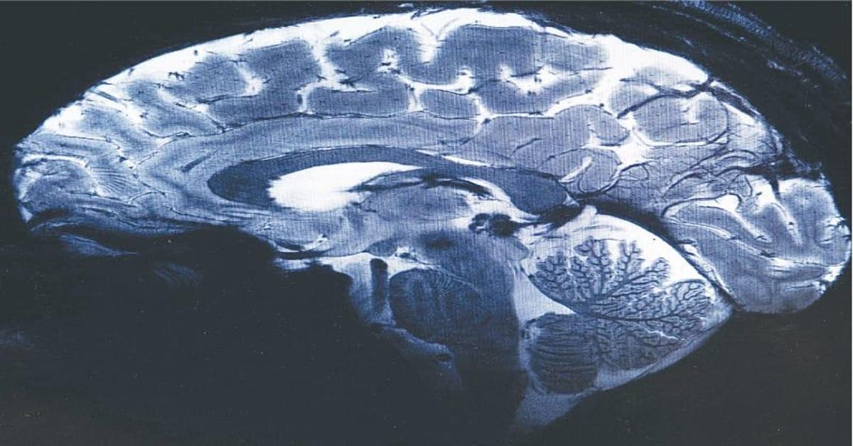 World's highly advanced MRI scans human brain for first time
