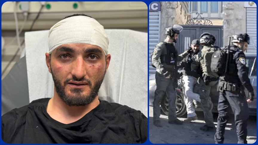AA photographer Mostafa Alkharouf, who was assaulted by Israeli soldiers in occupied East Jerusalem, is receiving treatment in the hospital, in Jerusalem, Palestine, Dec. 15, 2023. (AA Photo)