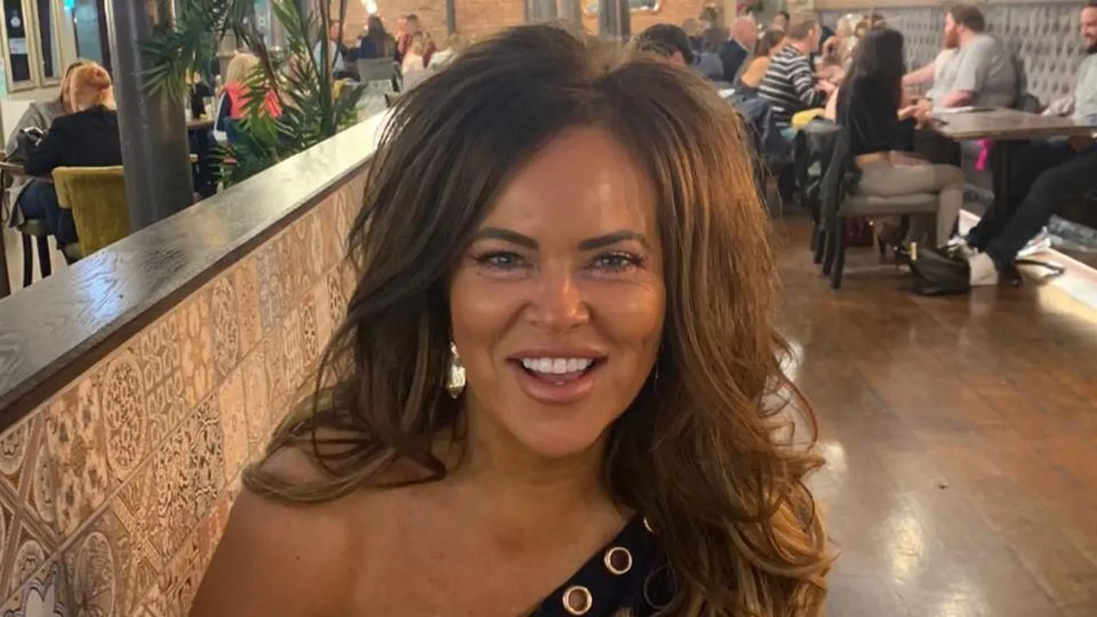 Welsh mother of 2 dies following weight-loss surgery in Türkiye