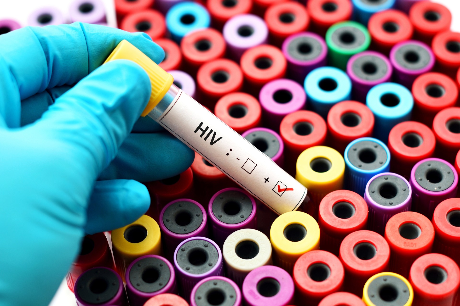 13-year-old boy's AIDS death in Izmir exposes Türkiye's rising child HIV cases
