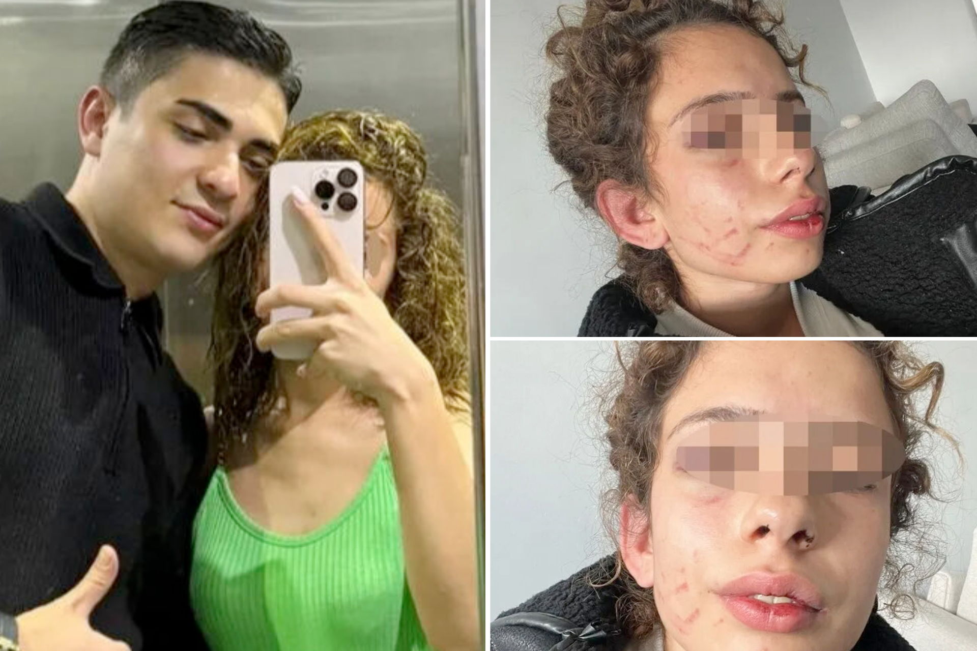 Turkish uni student brutally assaulted, suspect walks free under judicial control
