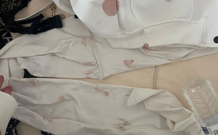 The blood-stained clothing presented by S.A. as evidence of the brutal assault she endured, Konya, Türkiye, Nov. 27, 2024. (Türkiye Daily Photo)