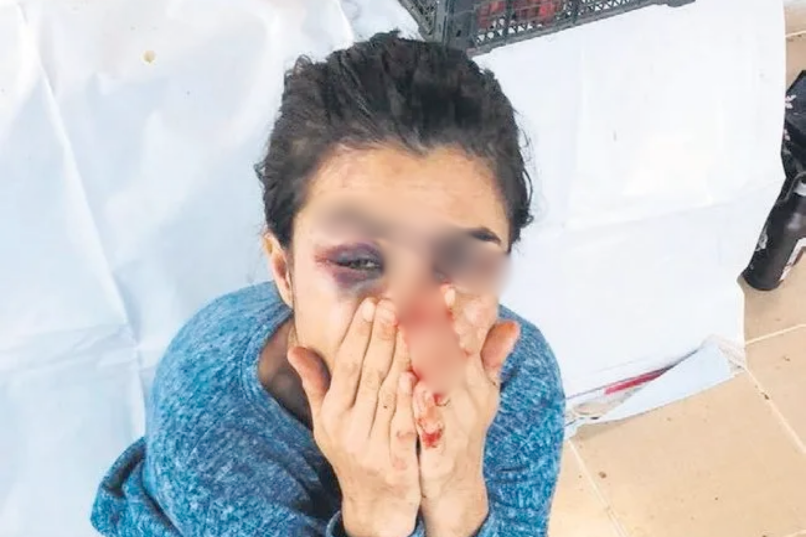 Melek Ipek with visible injuries after killing her abusive husband in self-defense. (Photo via X)