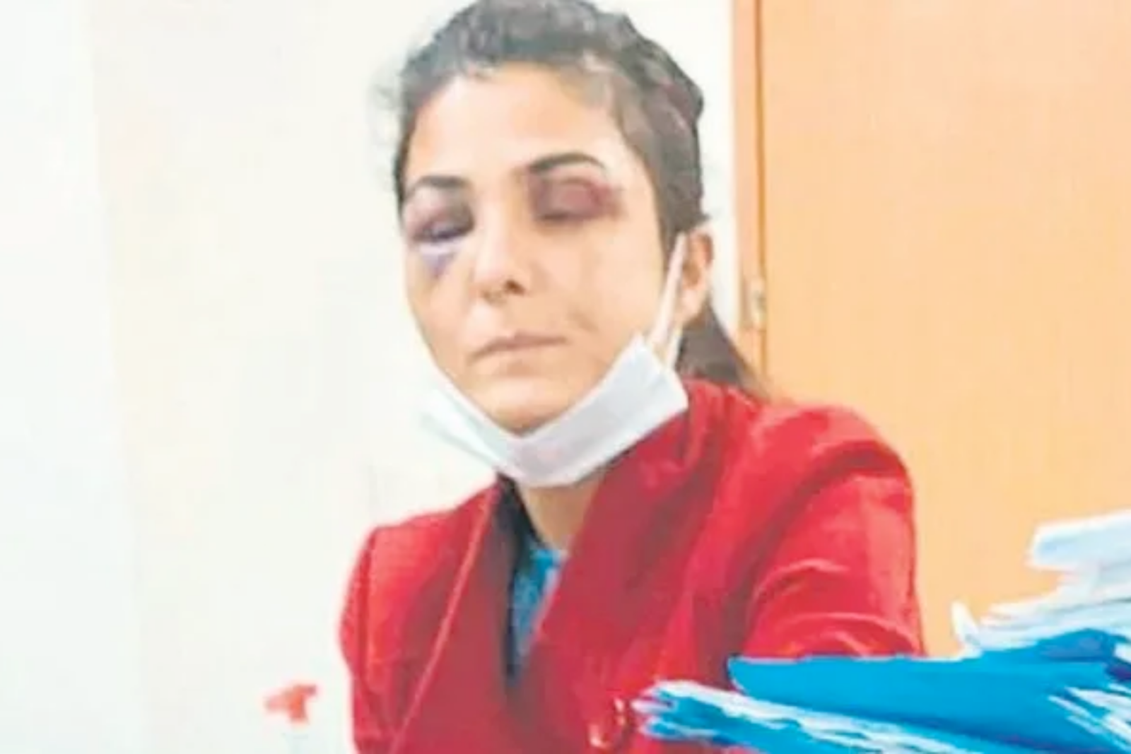 Turkish woman who was a victim of domestic abuse, Melek Ipek, with bruised eyes during her first court hearing. (Photo via X)