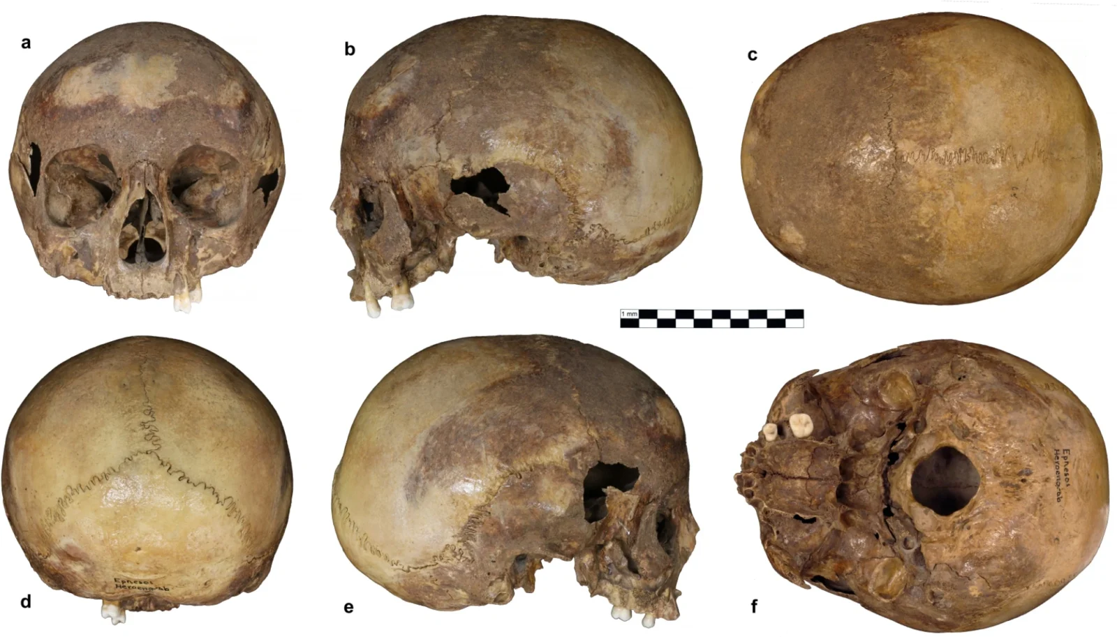 The cranium from the Octagon in Ephesos, Türkiye. (Photo via Scientific Reports)