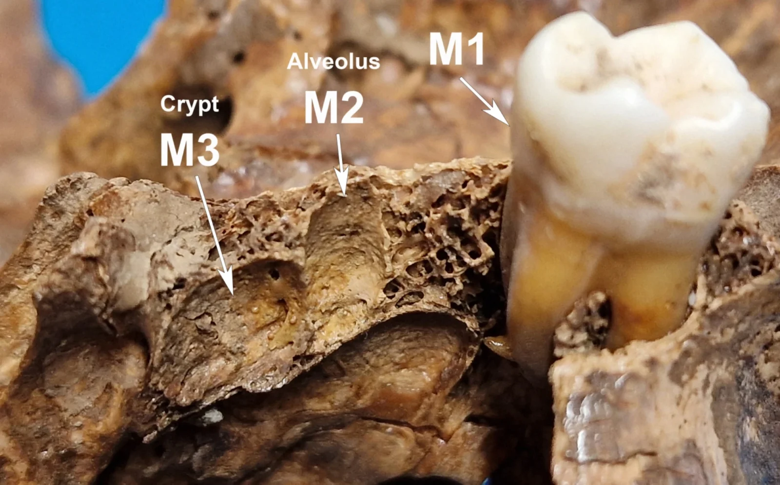 The bucco-occlusal view of the upper M1 and P3 was still in situ. While the latter erupting first premolar already shows significant wear on the buccal cusp, the first molar displays absolutely no signs of use. (Photo via Scientific Reports)