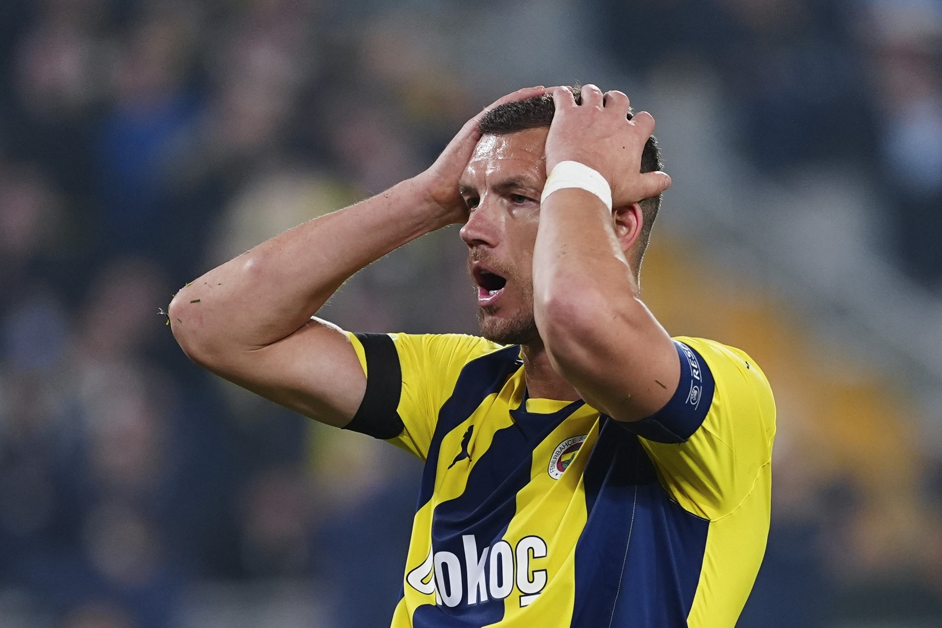 Fenerbahce's striker Dzeko breaks nose during national game