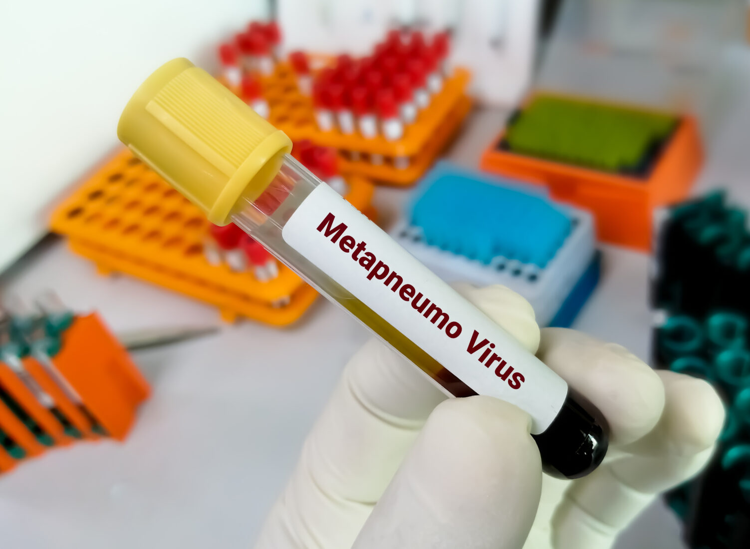 China faces a rise in human metapneumovirus (HMPV) cases during winter, with experts urging hygiene measures and calm. (Adobe Stock Photo)