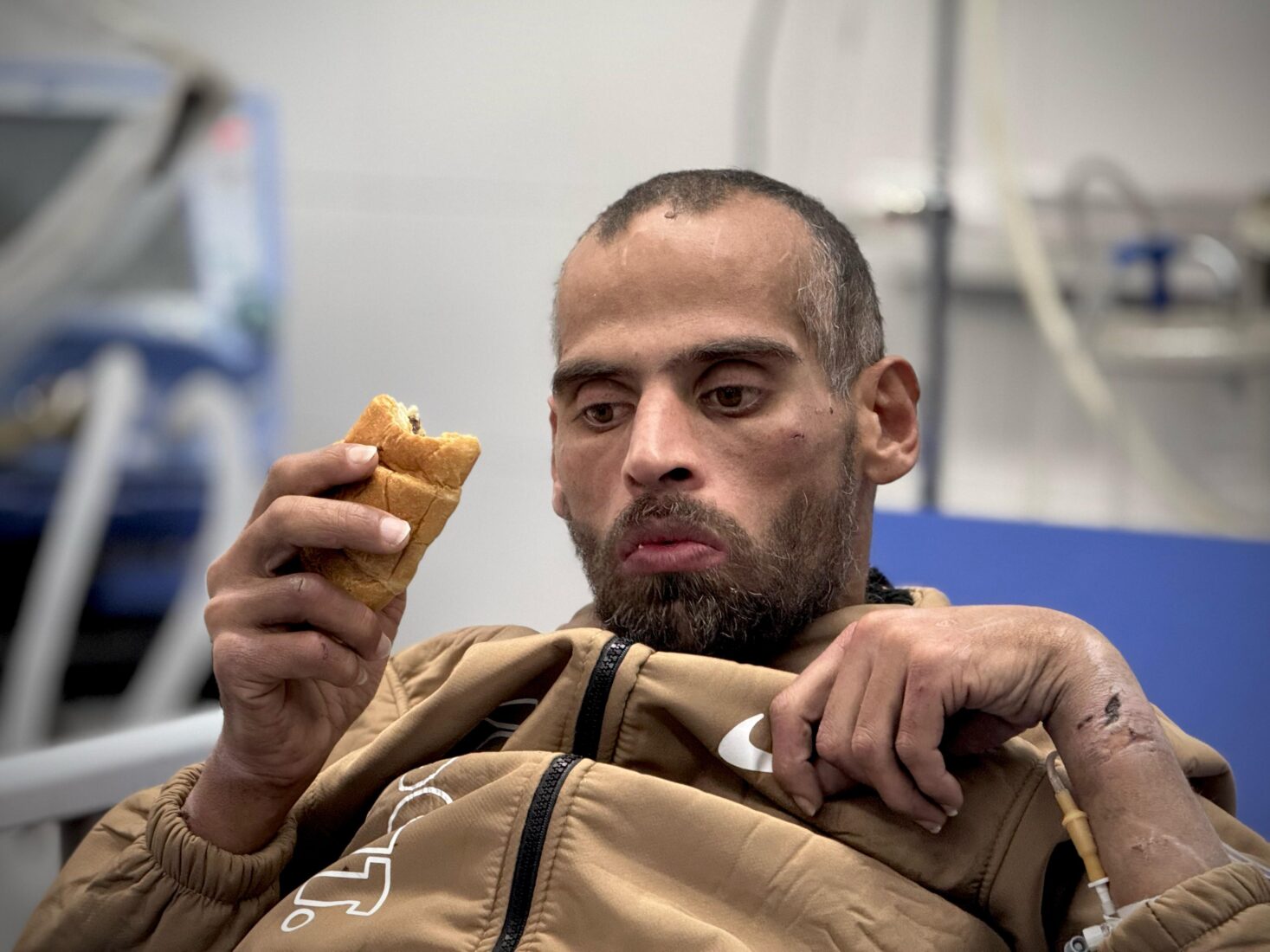 Gazan prisoner Nadir Jamal Hussein, released in the 6th round of the ceasefire and prisoner-hostage exchange agreement between Hamas and Israel, arrives at the European Hospital in Khan Yunis, Gaza, on Feb. 15, 2025. (AA Photo)