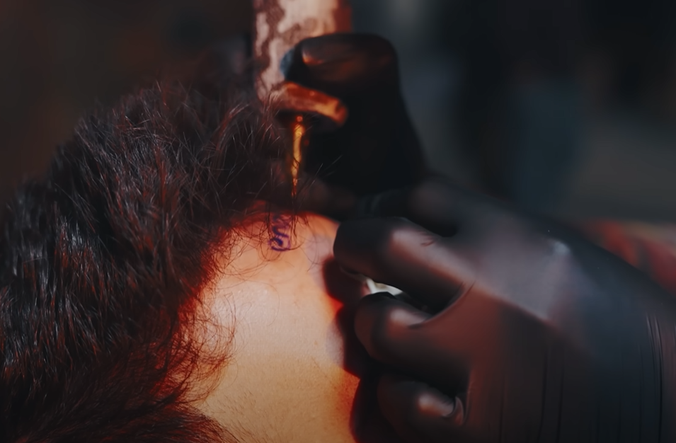 YouTube contestant in Türkiye gets ‘fool’ tattooed on forehead for $2,225