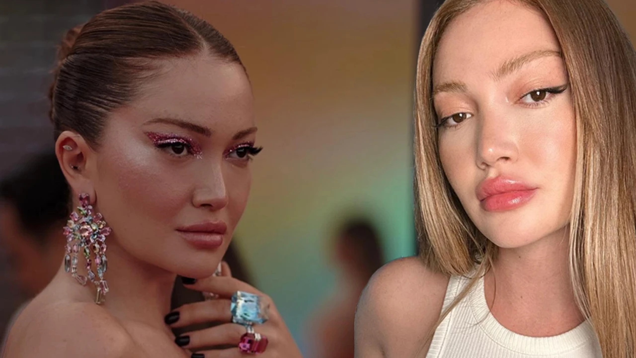 Aquafilling filler dangers exposed with Turkish influencer's shocking experience