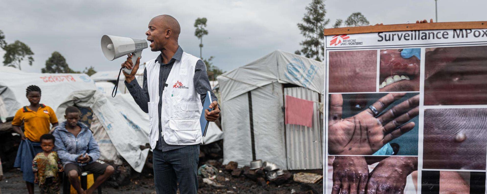1,300+ cases, 50+ deaths: DRC in grips of unidentified illness, mutant mpox