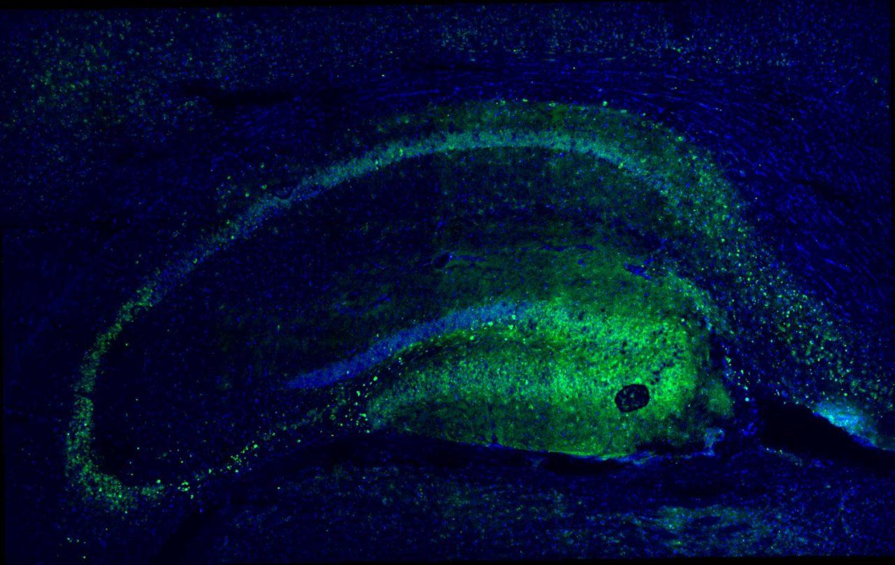 Brain cells, or oligodendrocytes (green), in the hippocampus, are marked with the GFP genetic marker in the mouse brain. These cells often deteriorate during aging, Mar. 5, 2025. (Courtesy of Science Advances)