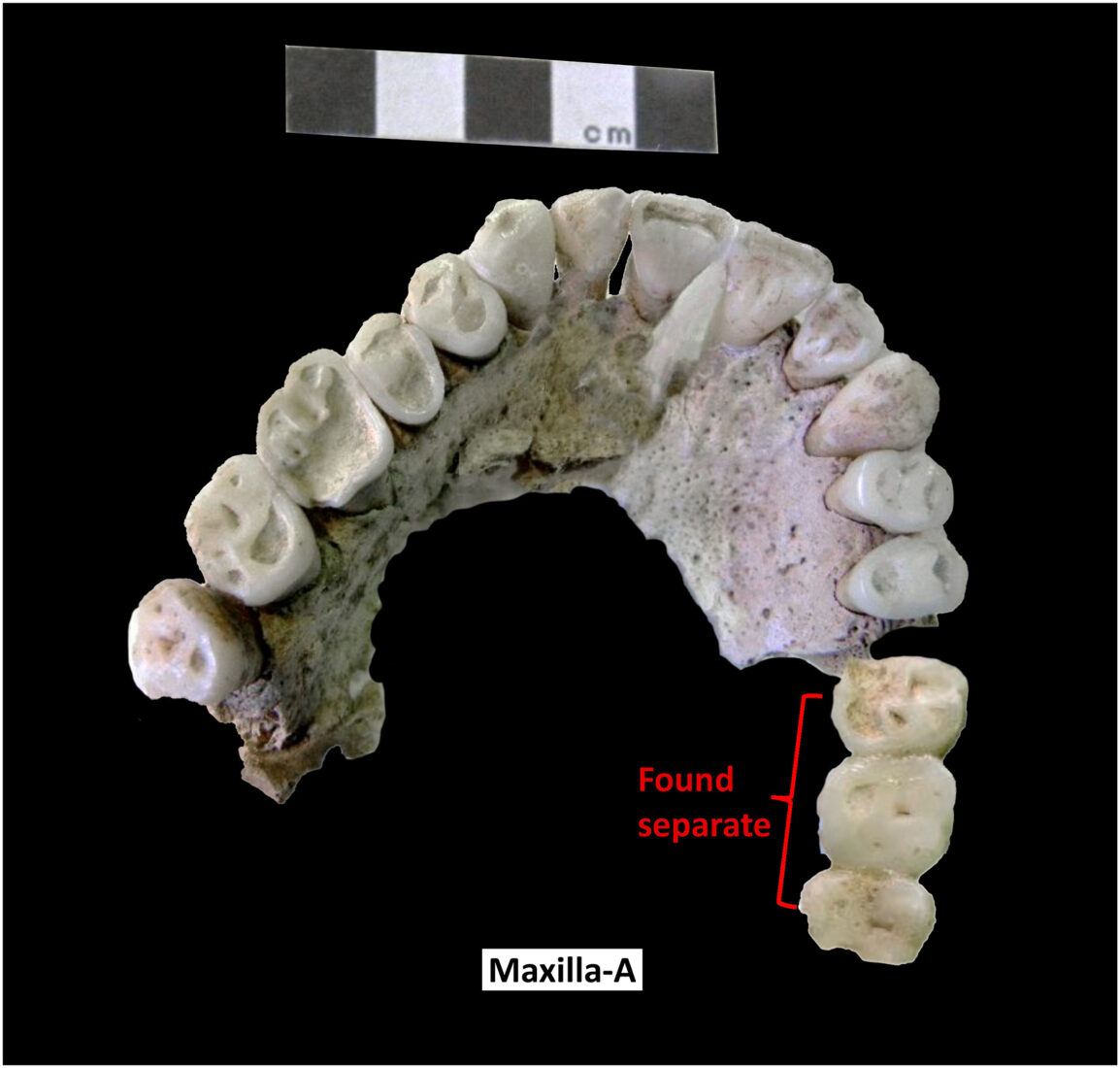 Maxilla-A (inferior view) from the same individual as Mandible-A