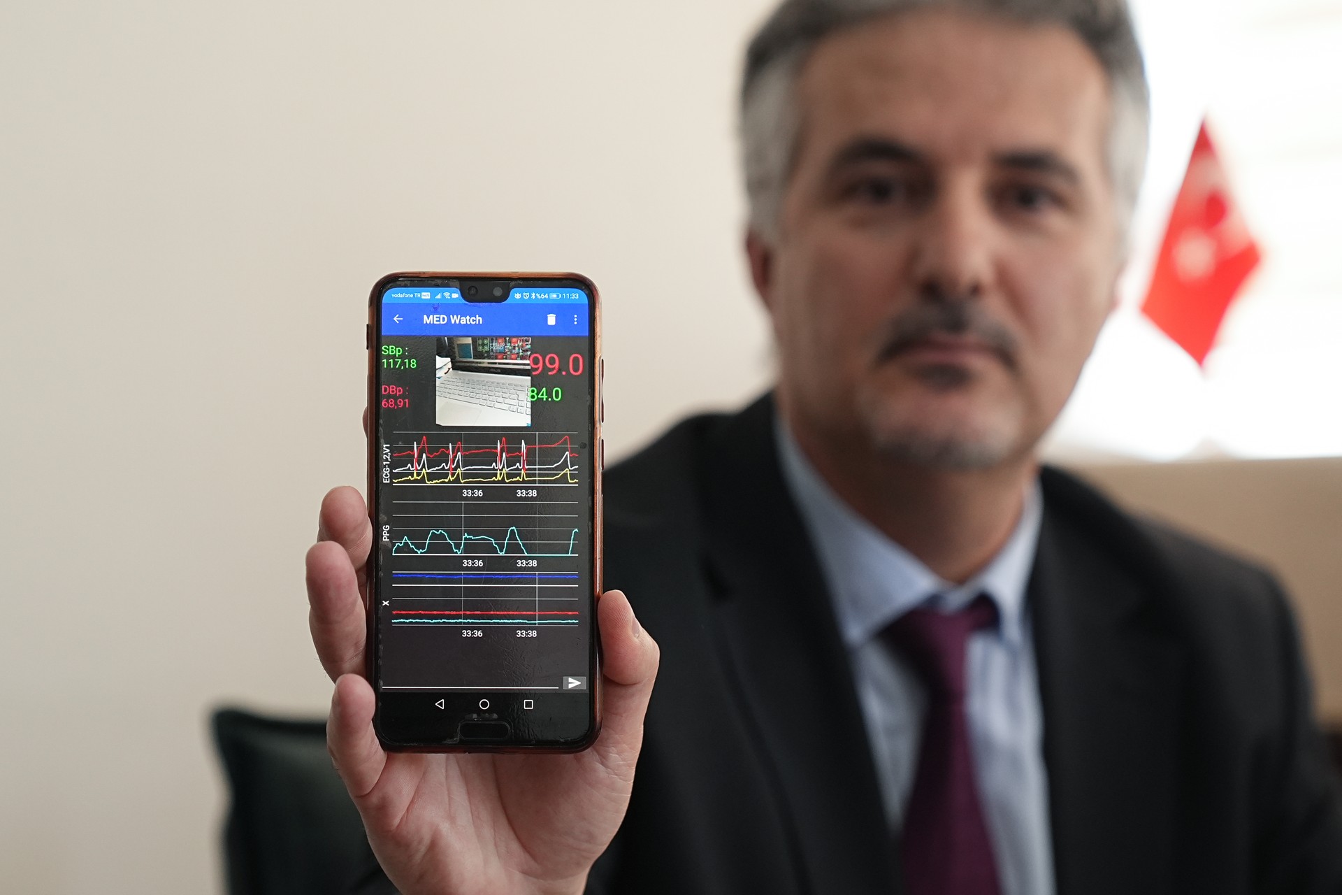 Turkish scientists' AI app detects early-stage lung cancer from voice with 90% accuracy