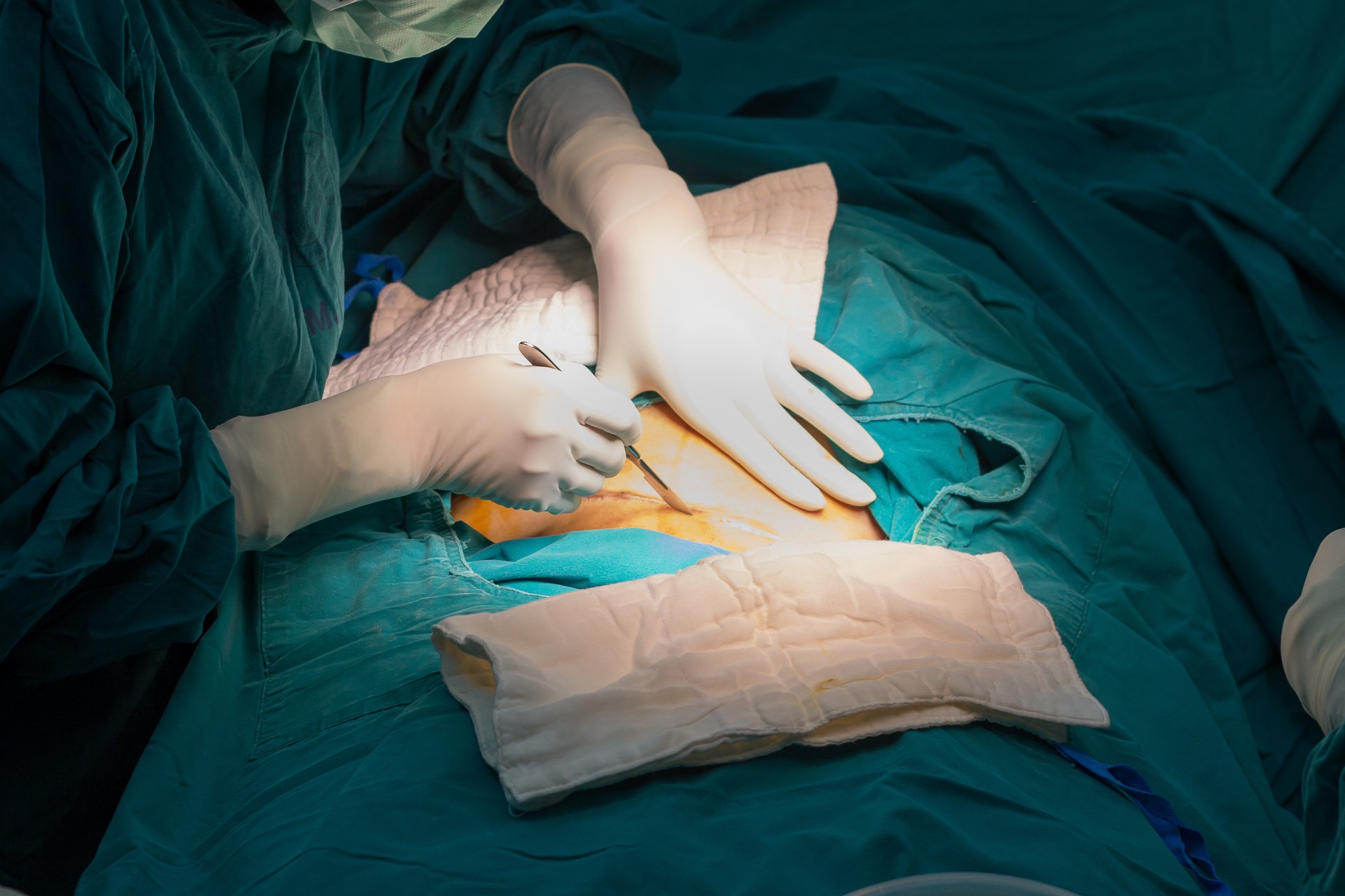Türkiye bans elective C-sections at medical centers in new health regulations Image