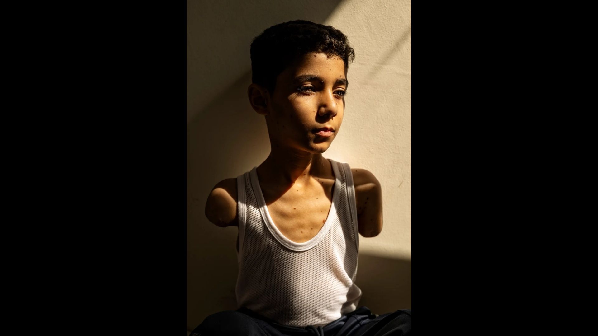 Samar Abu Elouf wins 2025 World Press Photo for haunting image of Gazan child survivor Image