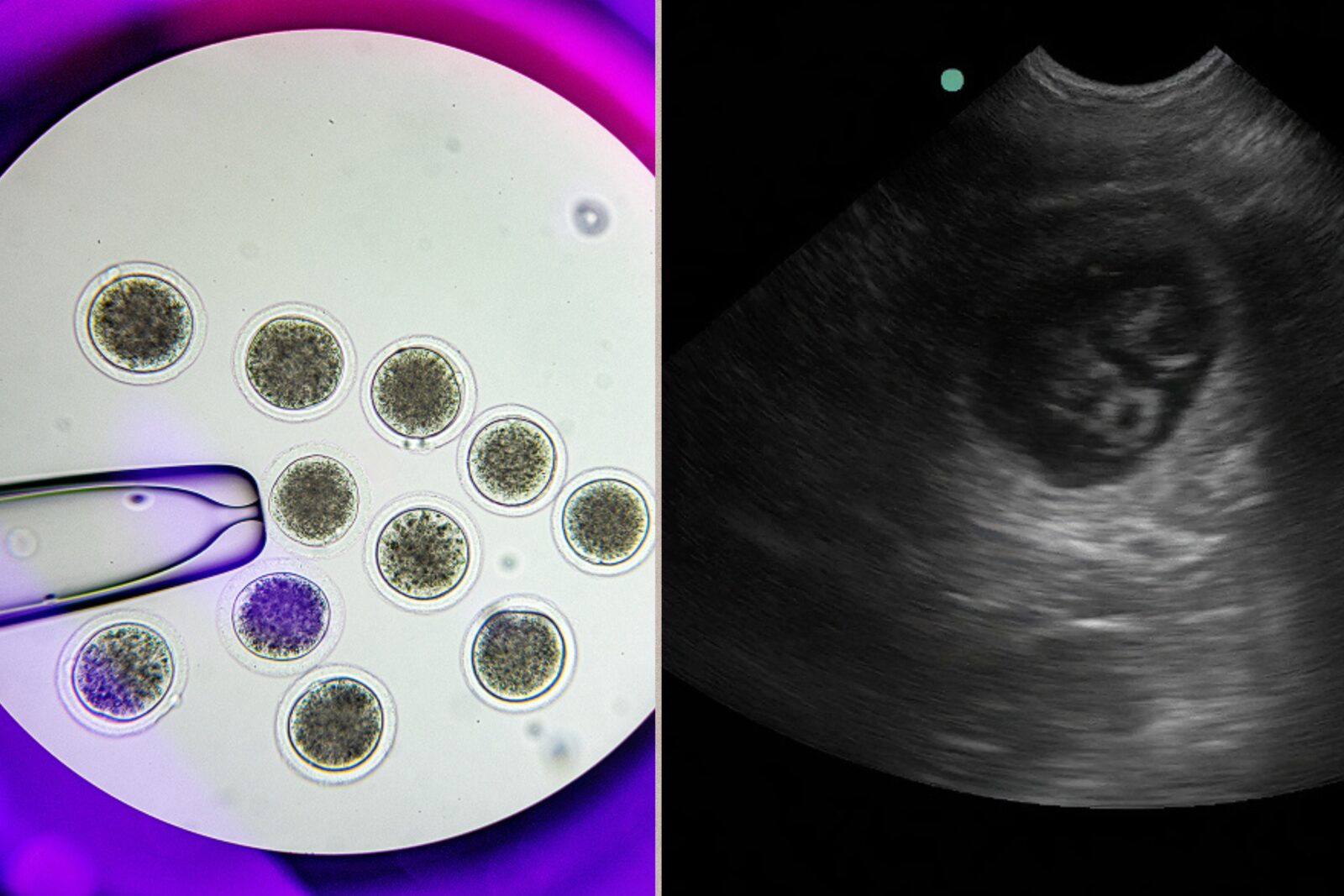 Embryo image (Left) and ultrasound image (Right) of Remus and Romulus. (Photos via Colossal Biosciences)