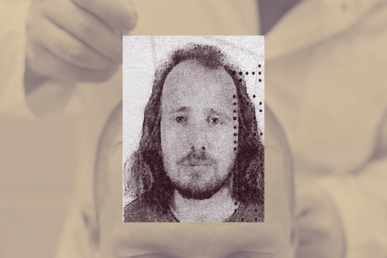 British man dies in Türkiye after hair transplant, dental treatment