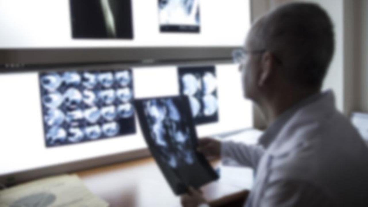 A doctor reviews neurological imaging at a Turkish hospital, accessed on June 7, 2025. (AA Photo)
