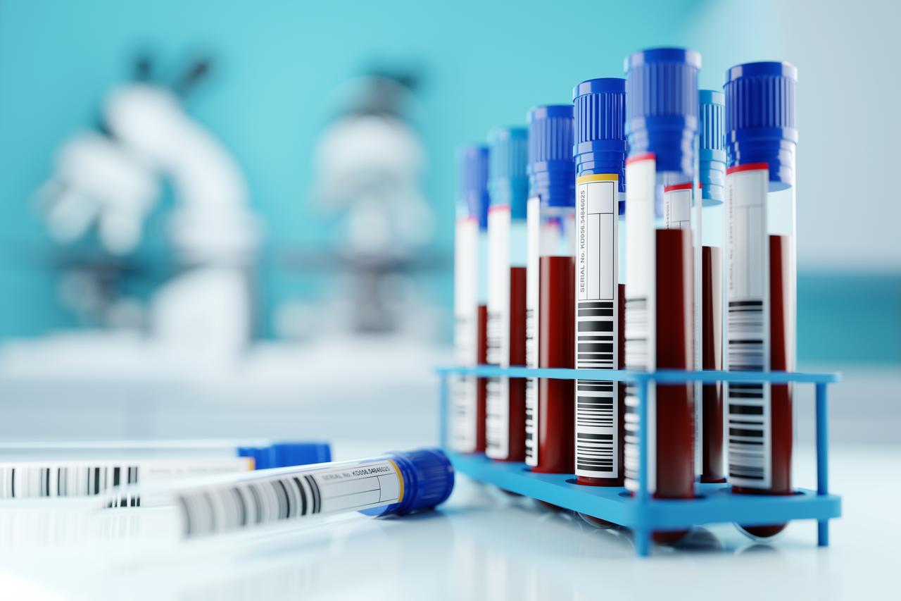 Illustration of human blood samples in a medical lab, accessed Jul. 14, 2025. (Adobe Stock Photo)