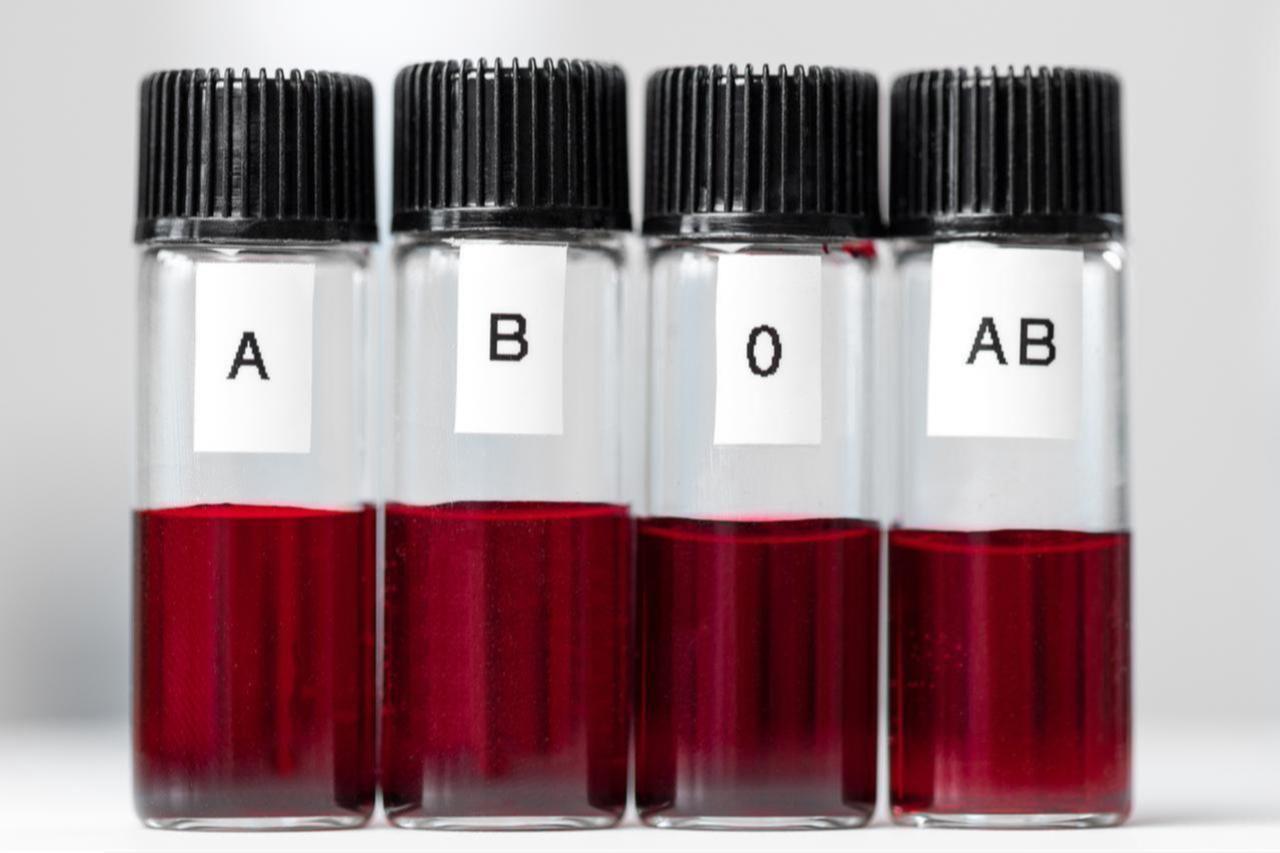 Samples of various human blood types, illustrating differences in AB, 0 and Rh classifications. (Adobe Stock Photo)