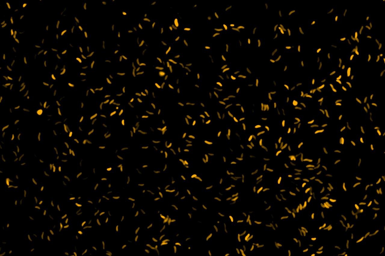 Microscope image of vibrio bacteria (aka vibrions). (Photo via Angela Marulanda/GEOMAR)