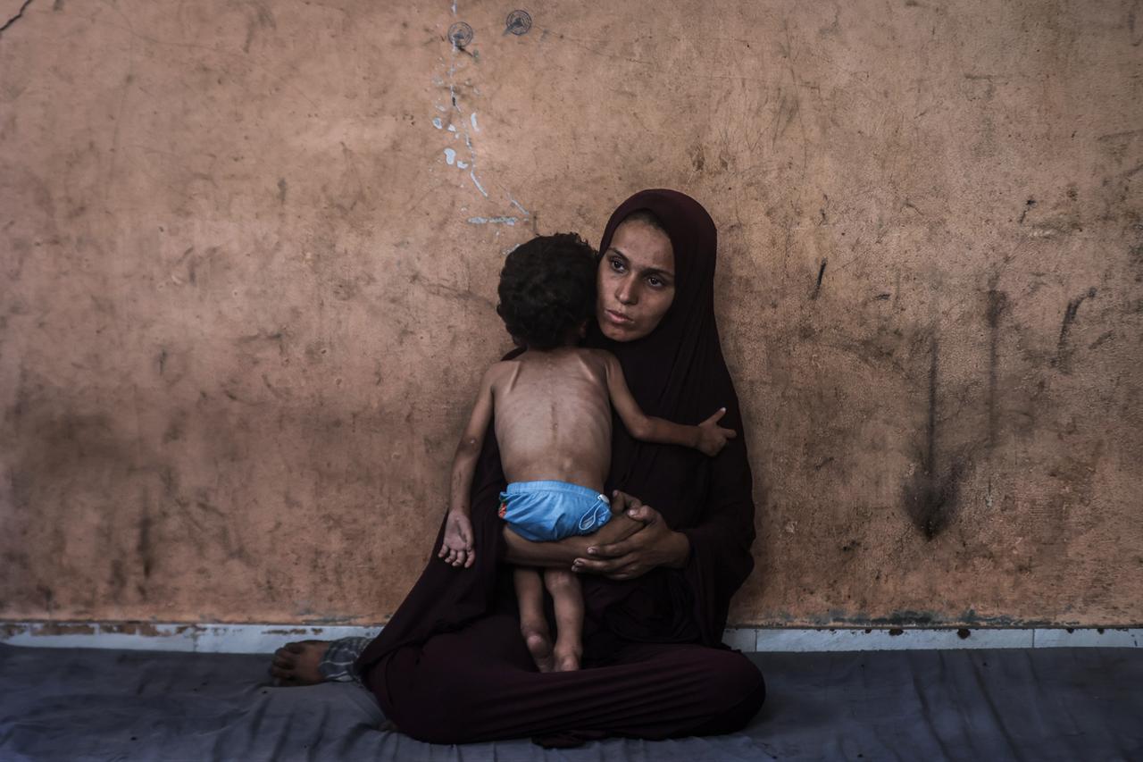 Israel uses starvation as weapon of genocide: Another child dies of hunger in Gaza  Image