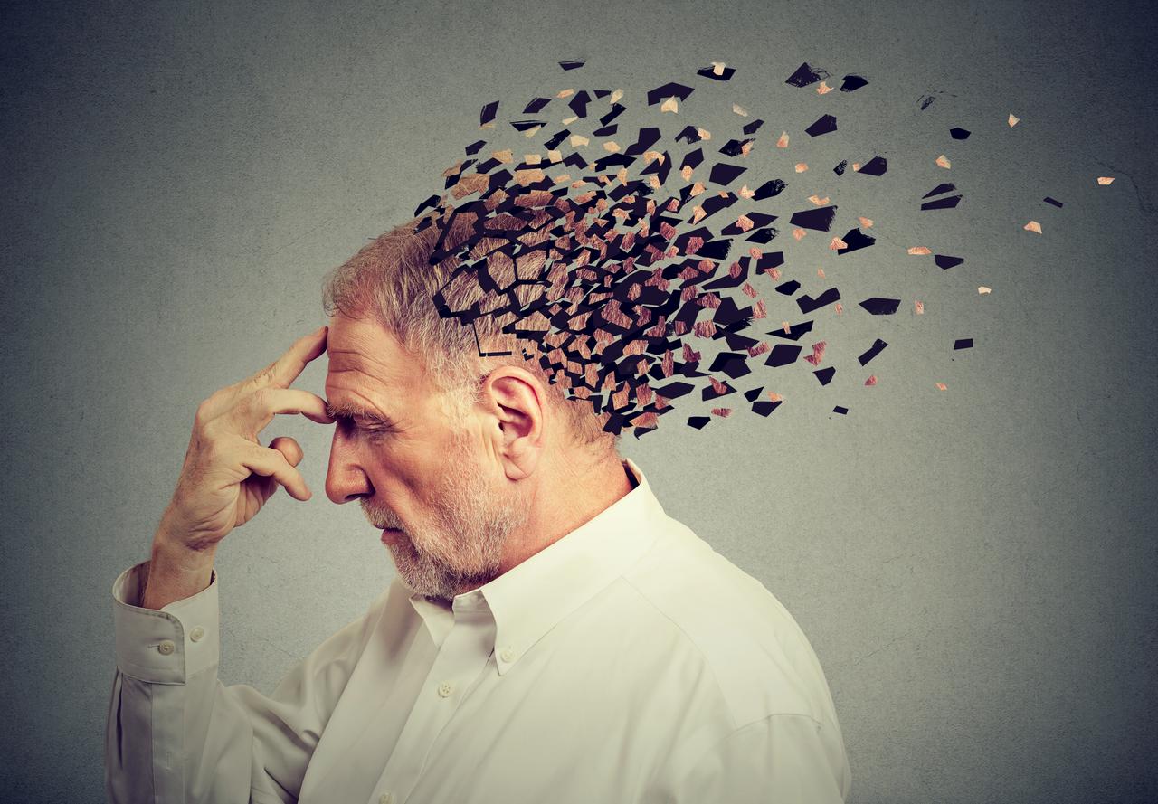 Memory decline from dementia. Elderly man with parts of his head fading away, symbolizing cognitive deterioration. (Adobe Stock Photo)