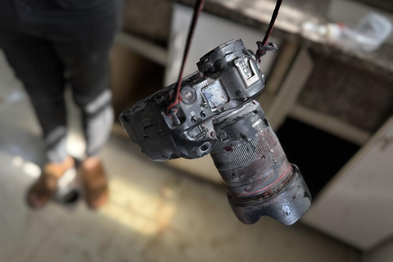 A camera with blood on it is seen on the Nasser Medical Complex in Khan Yunis, located in the southern Gaza Strip, on August 25, 2025. (AA Photo)