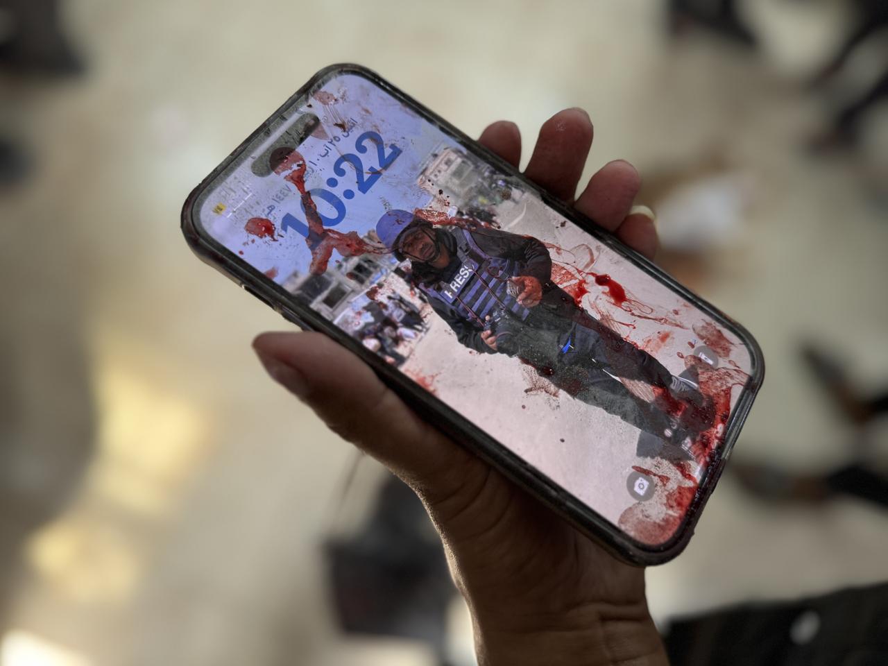 A bloody phone is seen with a photo of a member of the press on its screen following Israeli attack in the southern Gaza Strip, August 25, 2025. (AA Photo)