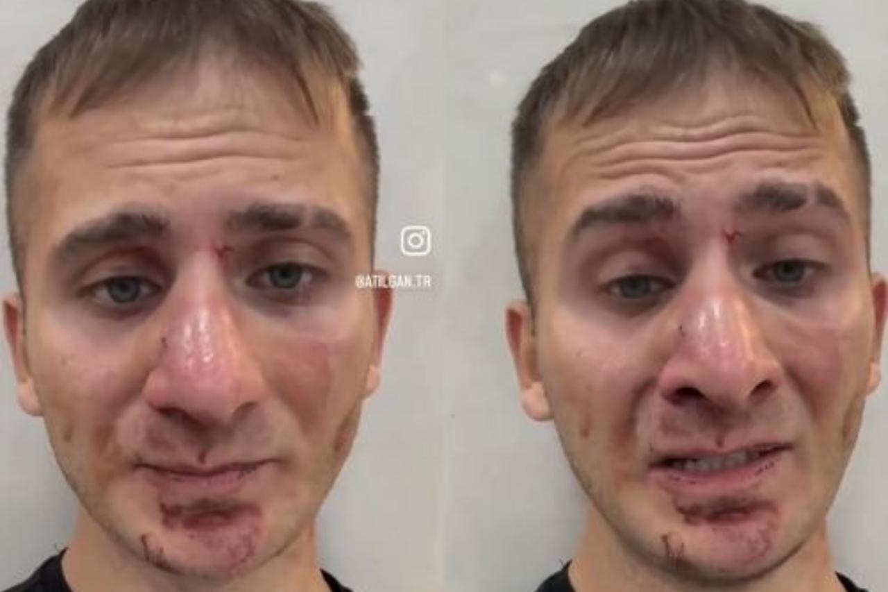 Turkish traveler Taha Yaman Kilinak’s Instagram post after being robbed and kidnapped by a cartel in Ecuador. (Photo via Instagram/ @atilgan.tr)
