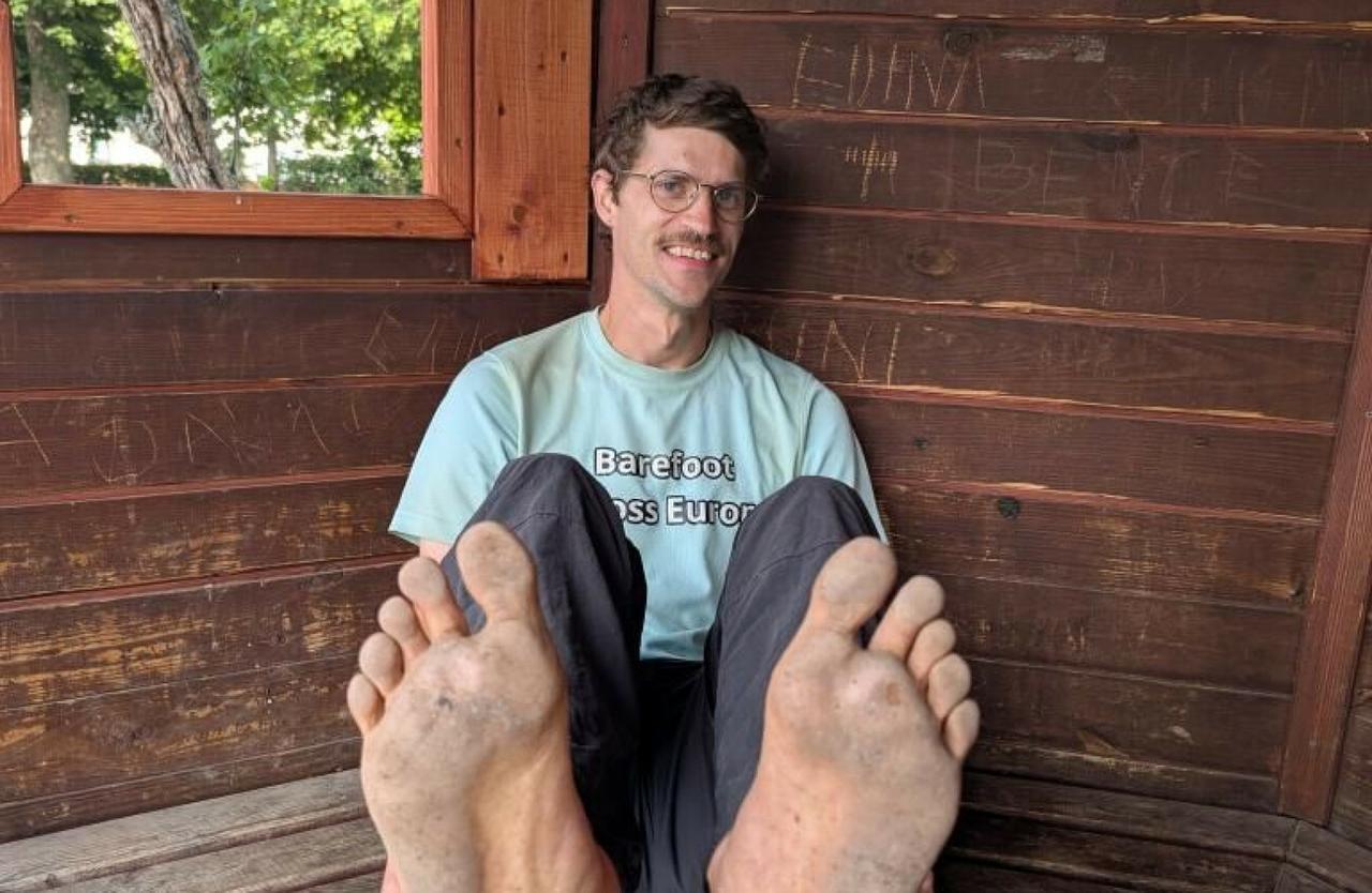 Eamonn Keaveny rests at a wooden shelter and shows the condition of his feet after months on the road. (Courtesy of Eamonn Keaveny/Jigsaw)