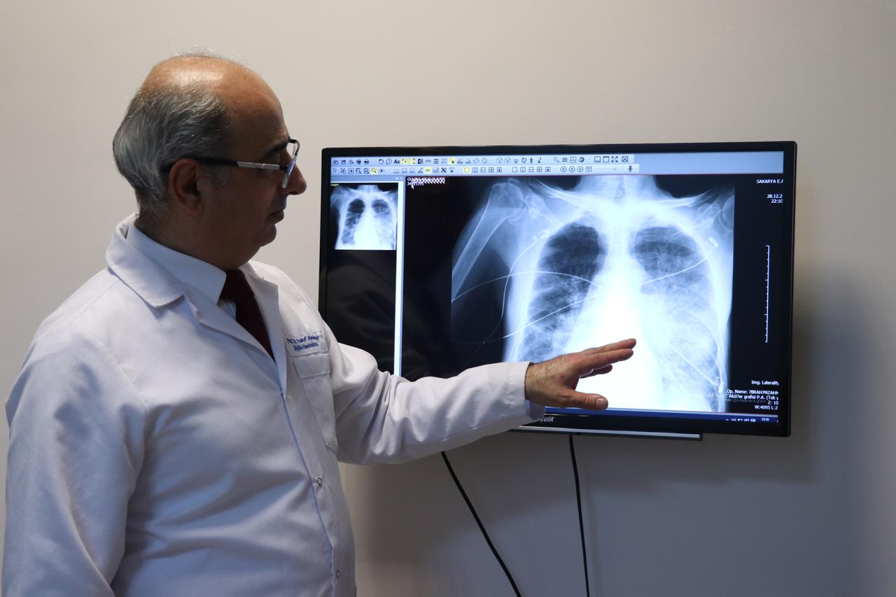 Prof. Dr. Yusuf Aydemir, head of the Chest Diseases Department at Sakarya University Faculty of Medicine, points to a lung X-ray while explaining damage linked to electronic cigarette use. (AA Photo)