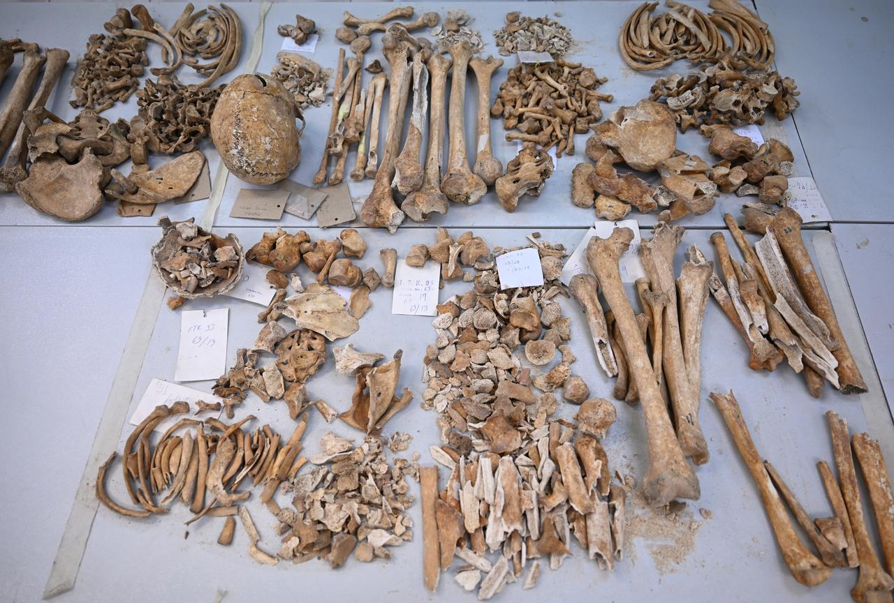 Bone fragments recovered from excavations at Cayonu Hill in Diyarbakir province are laid out for laboratory analysis at Hacettepe University in Ankara, Türkiye, Jan. 5, 2026. (AA Photo)
