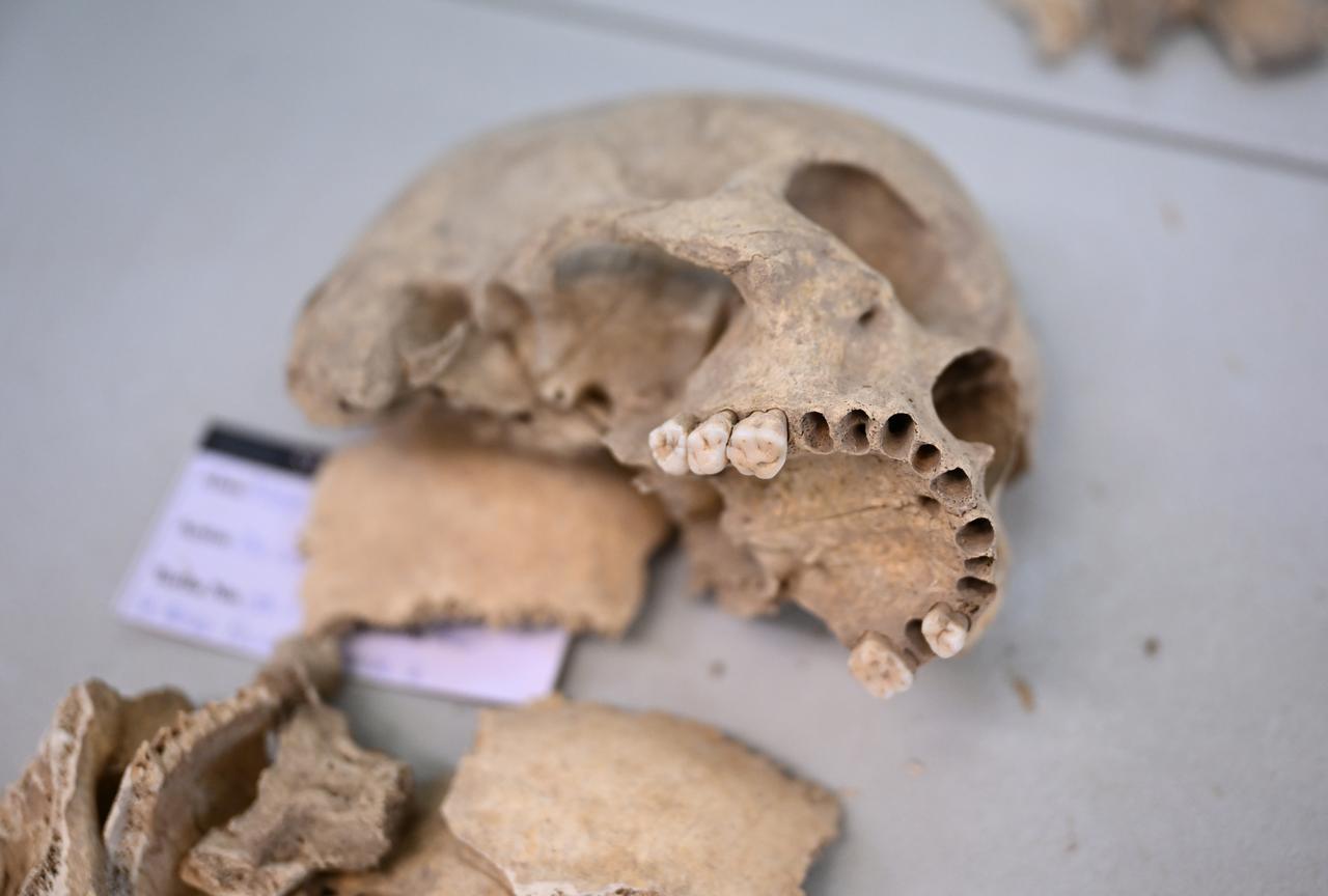 A human skull excavated from Cayonu Hill is seen during laboratory documentation at Hacettepe University in Ankara, Türkiye, Jan. 5, 2026. (AA Photo)