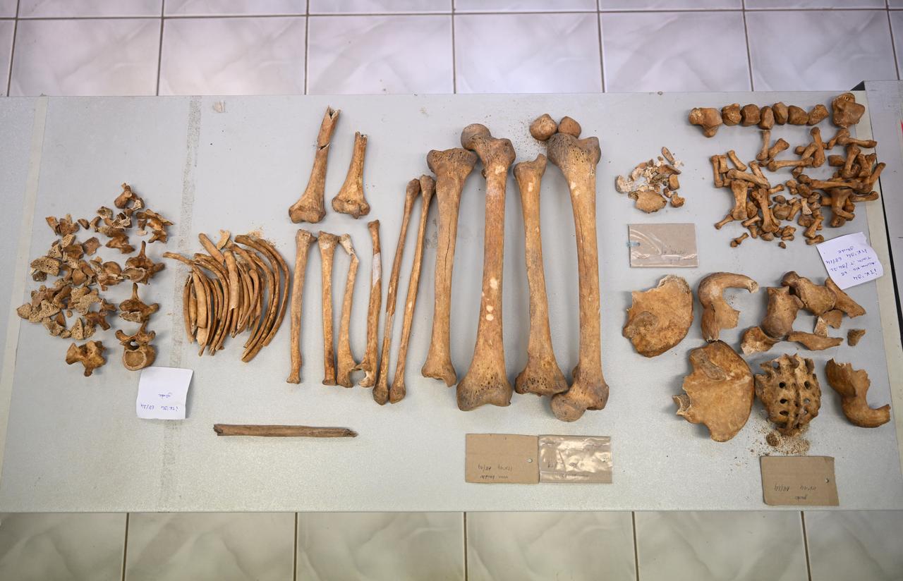 Bone fragments recovered from excavations at Cayonu Hill in Diyarbakir province are laid out for laboratory analysis at Hacettepe University in Ankara, Türkiye, Jan. 5, 2026. (AA Photo)