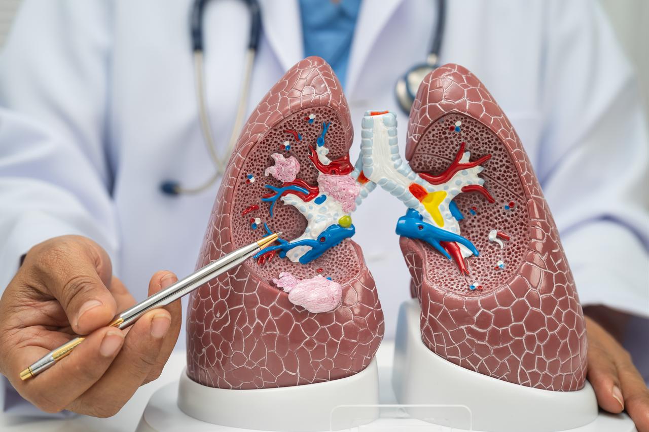 A doctor uses an anatomical model of human lungs to explain the respiratory system. (Adobe Stock Photo)