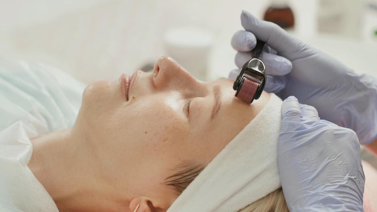 A woman receives a microneedling treatment on her forehead during a cosmetic skincare procedure. (Adobe Stock Photo)