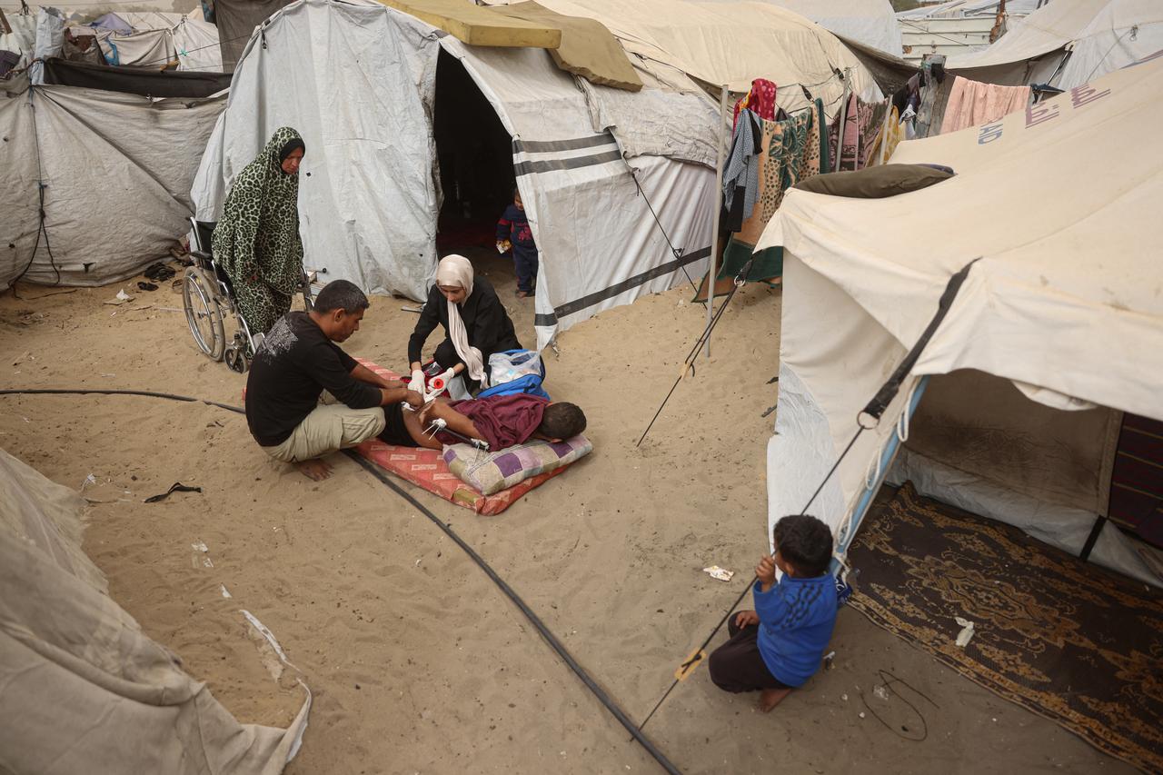 Displaced Palestinian nurse, 23-year-old Dalia Taha Abu Zarifa, attends to a patient who is seriously ill and who cannot make daily visits to a hospital, in the Al-Mawasi area of Khan Yunis in the southern Gaza Strip on February 14, 2026. (AFP Photo)