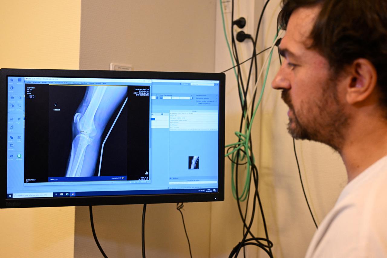 A doctor looks at an x-ray on a screen, helped by AI for medical imaging which indicates possible bone fractures and dislocations at the university hospital in Rennes, western France, Sept. 26, 2023. (AFP Photo)