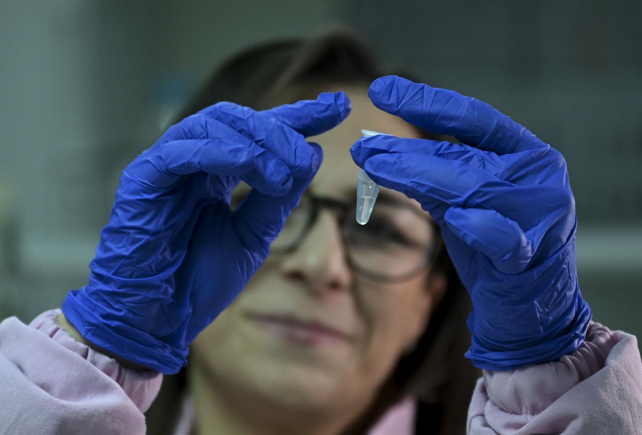Assoc. Prof. Acelya Yilmazer Aktuna examines a sample as part of cancer research at Ankara University’s Biomedical Engineering laboratory in Ankara, Türkiye, March 2, 2026. (AA Photo)