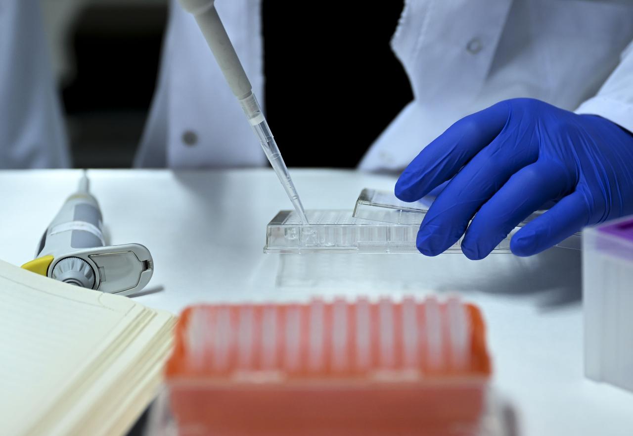A researcher handles laboratory samples during cancer treatment research at Ankara University in Ankara, Türkiye, March 2, 2026. (AA Photo)