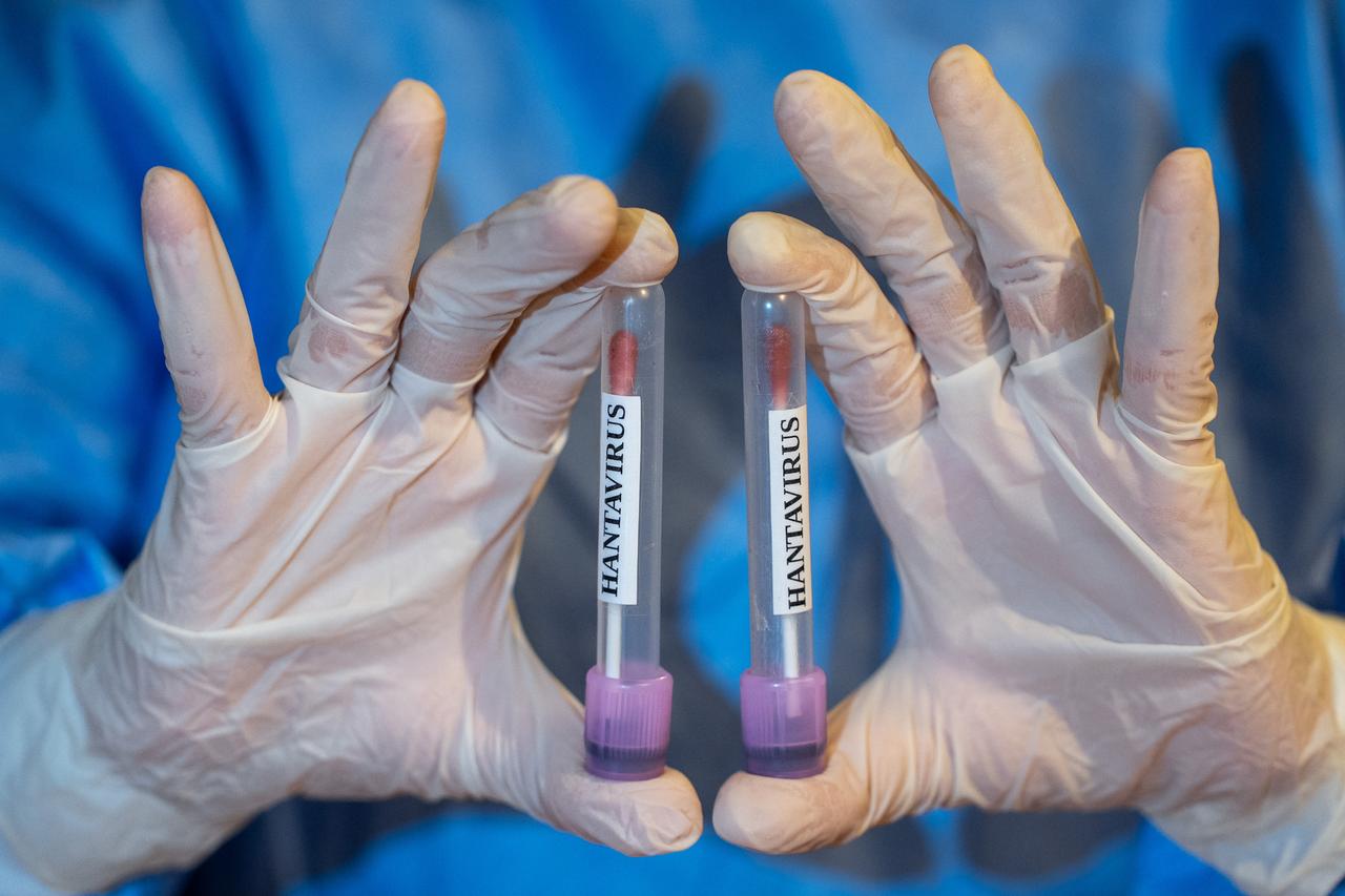 WHO chief heads to Tenerife as hantavirus cruise crisis triggers evacuation