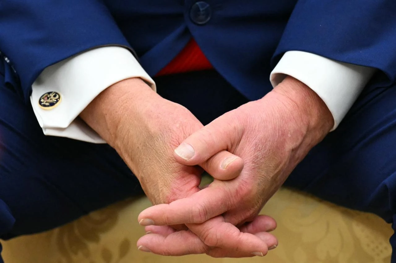 US President Donald Trump clasps his hands as he meets with Lebanese President Joseph Aoun in the Oval Office of the White House in Washington, DC, on July 21, 2026. (AFP Photo)