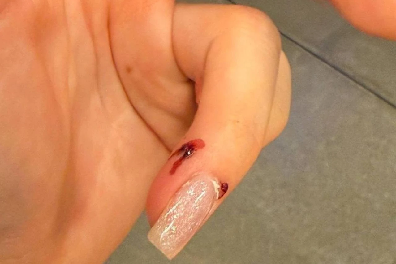 Russian tourist cuts Venice trip short after man throws rat at her
