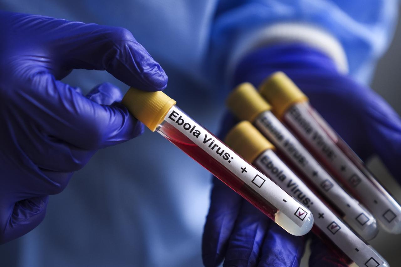 WHO says full scope of DRC Ebola outbreak still unclear Image