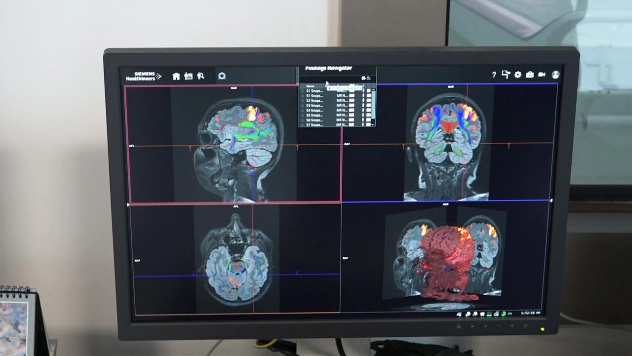 Türkiye's Council of Higher Education announced that the Neuroscience and Neurotechnology Center of Excellence Joint Application and Research Center (NOROM) has been accepted into the test network of NATO’s Defence Innovation Accelerator for the North Atlantic (DIANA), Aug. 23, 2026. (AA Photo)